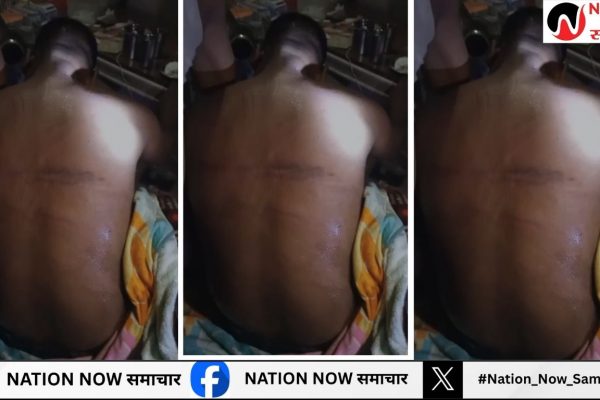 दबंगई का अंजाम कथित भाजपा नेता की पिटाई