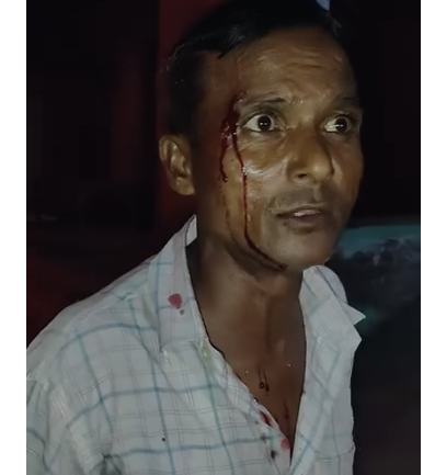 औरैया बिधूना में दरोगा पर मारपीट का आरोप, व्यक्ति के सिर-चेहरे पर चोट फर्जी मुकदमे में फंसाने की धमकी का दावा 2 image 83 1
