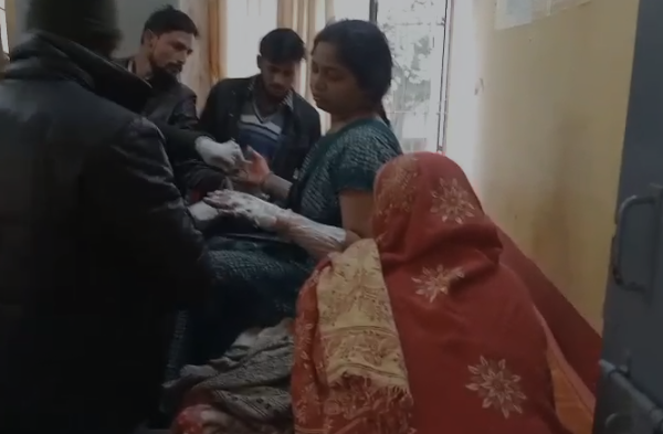 बिधूना में संतान न होने से परेशान महिला ने लगाई आग, हालत गंभीर