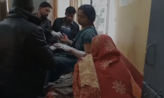 बिधूना में संतान न होने से परेशान महिला ने लगाई आग, हालत गंभीर