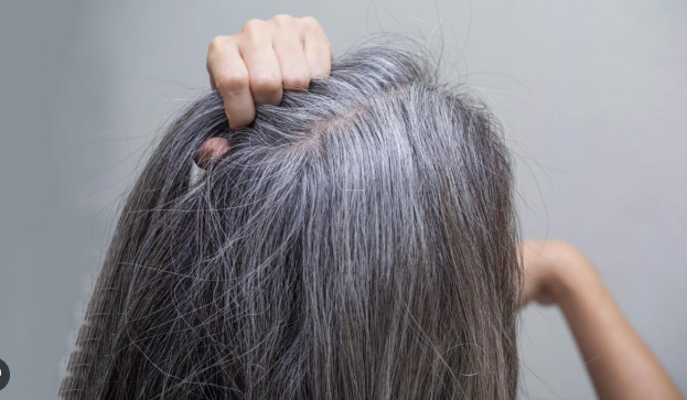 White Hair: असमय सफेद बालों के पीछे के कारण और रोकथाम